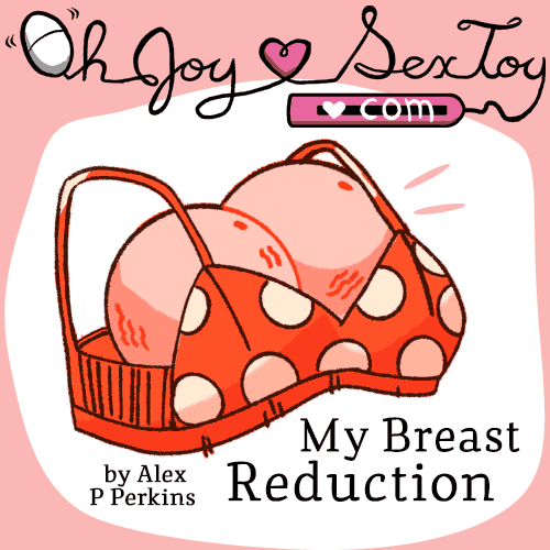 My Breast Reduction by Alex P Perkins