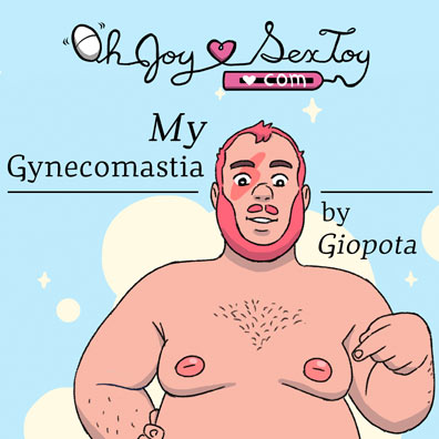 My Gynecomastia by Giopota